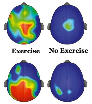 Exercise brain